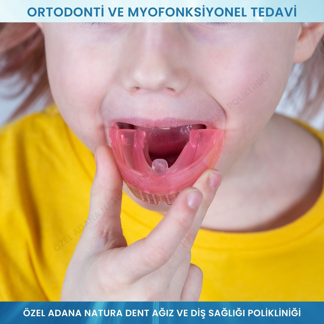 Ortodonti ve Myofonksiyonel Tedavi