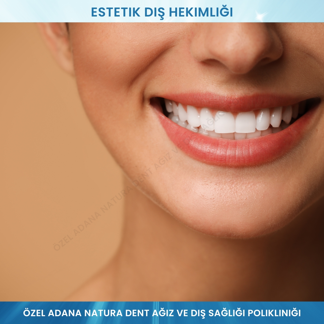 Estetik Diş Hekimliği