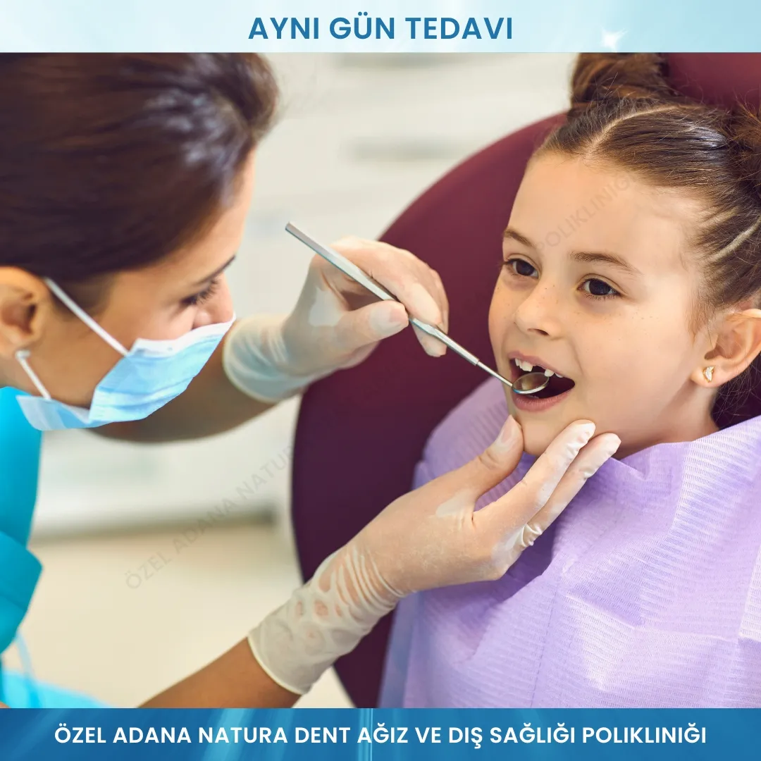 Aynı Gün Tedavi: Anında Gülümseme, Hızlı ve Kaliteli