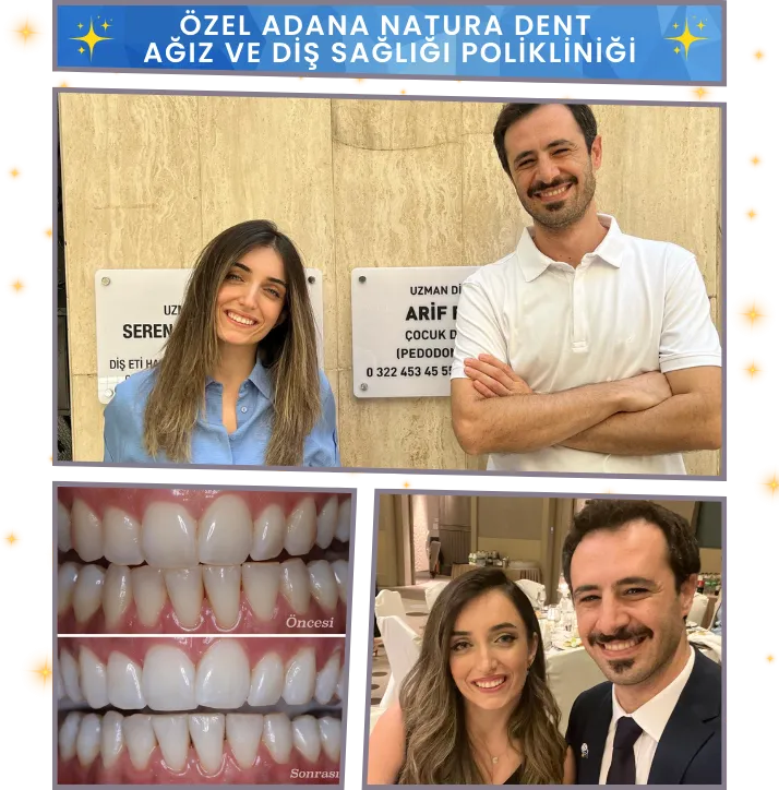 Özel Adana Natura Dent Ağız & Diş Sağlığı Polikliniği - Uzm. Dt. Seren Sürmeli Baran - Uzm. Dt Arif Baran - Adana Dent