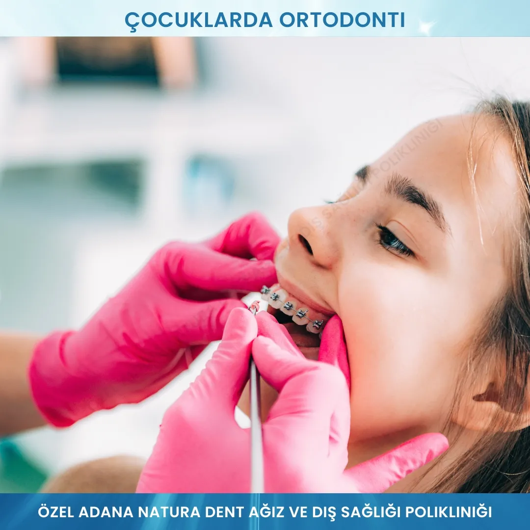 Çocuklarda Ortodonti: Sağlıklı Gülüşler İçin Erken Dönem Takibi