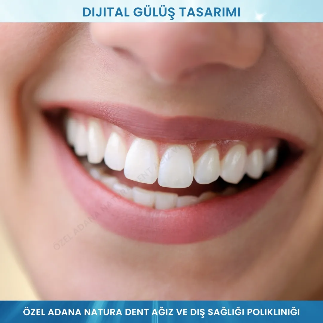 Dijital Gülüş Tasarımı: Gülüşünüzü Önceden Görün, Mükemmelliği Planlayın