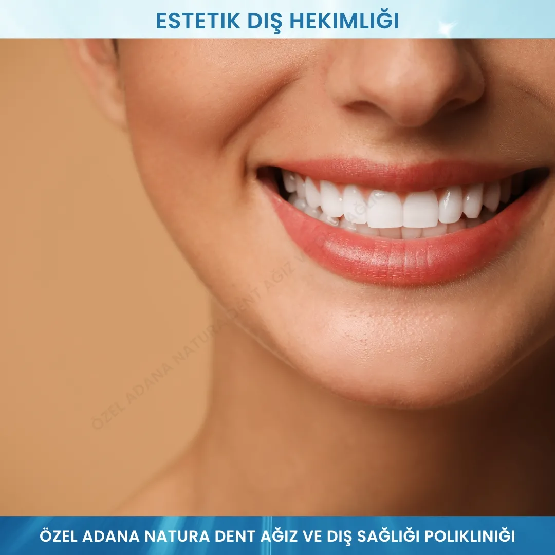 Estetik Diş Hekimliği: Mükemmel Gülüşünüz İçin Profesyonel Çözümler