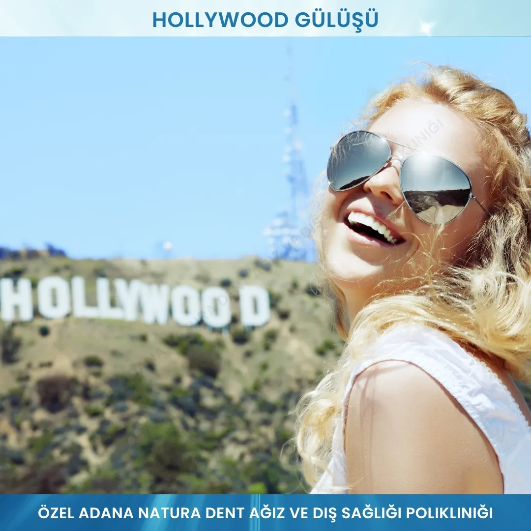 Hollywood Smile - Hollywood Gülüşü: Mükemmel Gülüşünüz İçin Profesyonel Çözümler