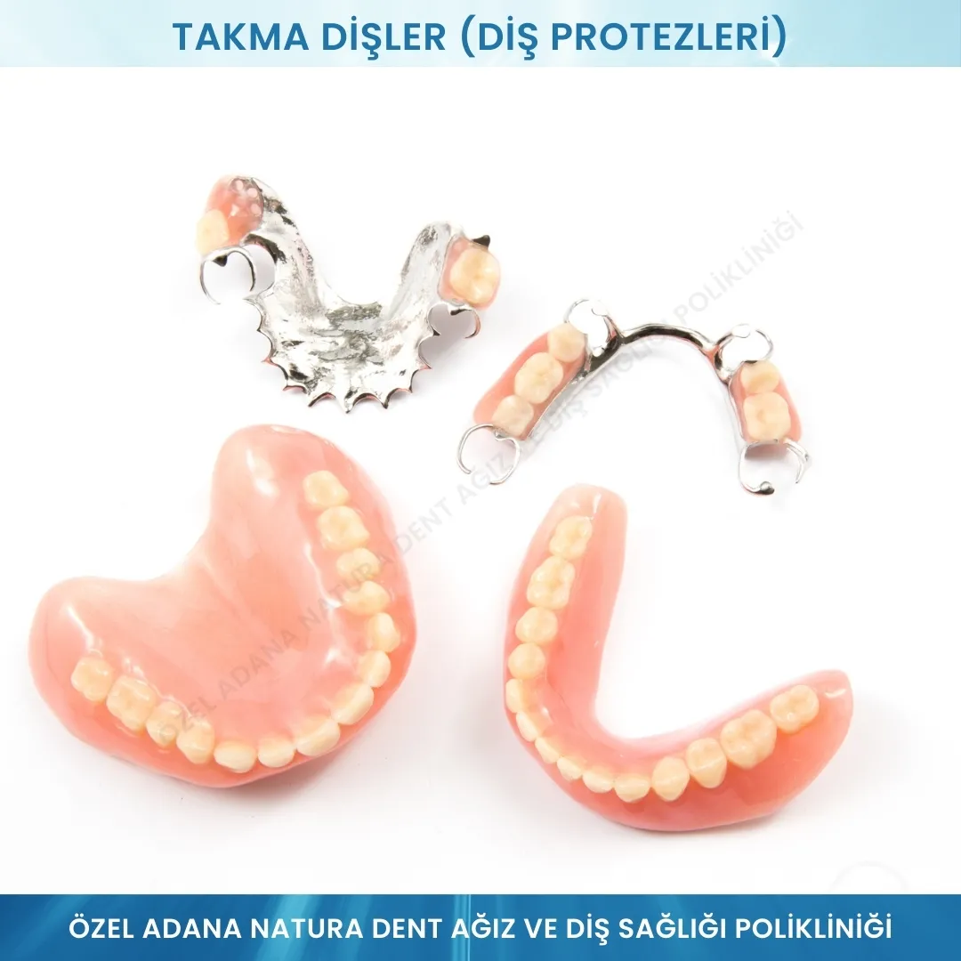 Takma Dişler (Diş Protezleri): Eksik Dişler İçin Konforlu ve Estetik Çözümler