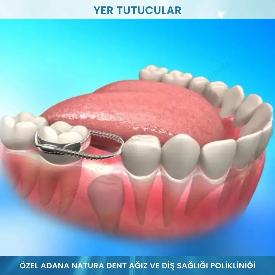 Yer Tutucular: Süt Dişlerinin Koruyucusu