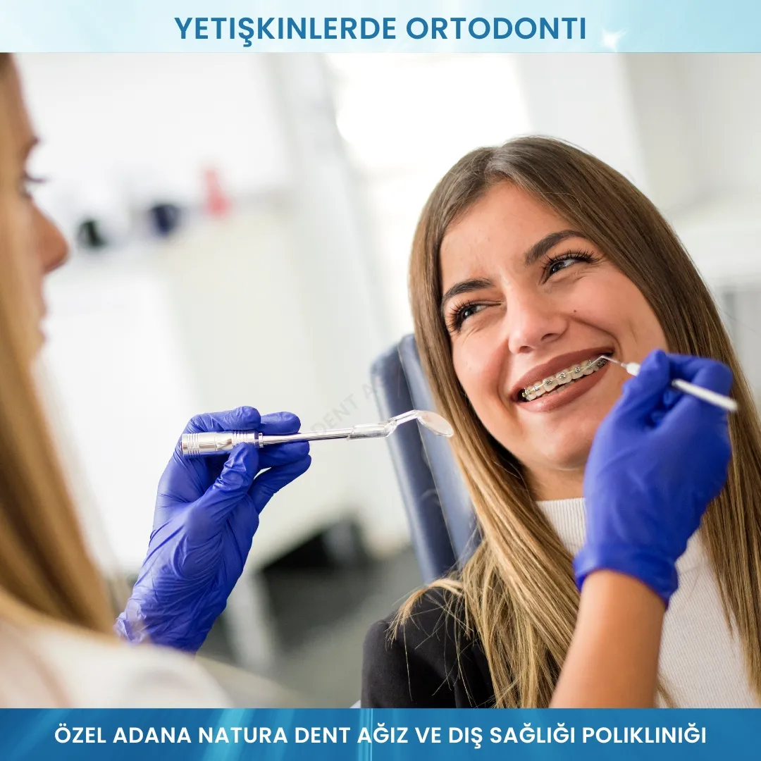 Yetişkinlerde Ortodonti: Her Yaşta Sağlıklı ve Estetik Gülüşler Mümkün